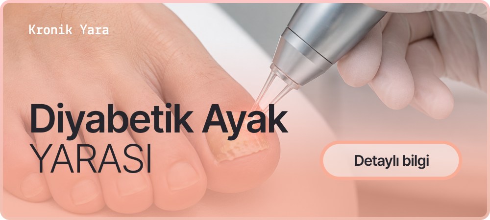 Diyabetik Ayak Yarası Hakkında Daha Fazla Bilgi